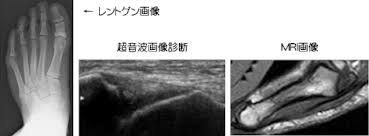 超音波エコー診断